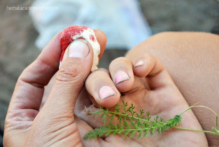 gauze on injured finger with yarrow leaves laying on hand