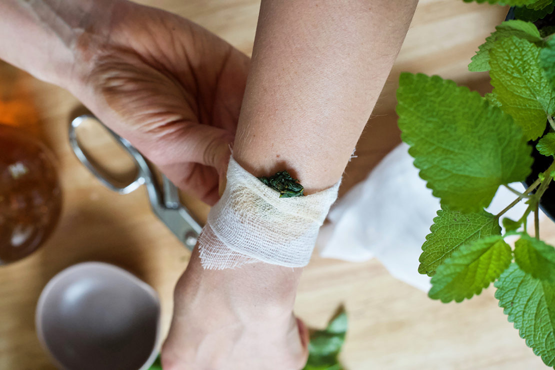 Easy DIY Bee Sting Poultice | Herbal Academy | As beautiful as it is to be outdoors in nature with the bees—sometimes you get stung! Learn how to make an herbal DIY bee sting poultice in this article.