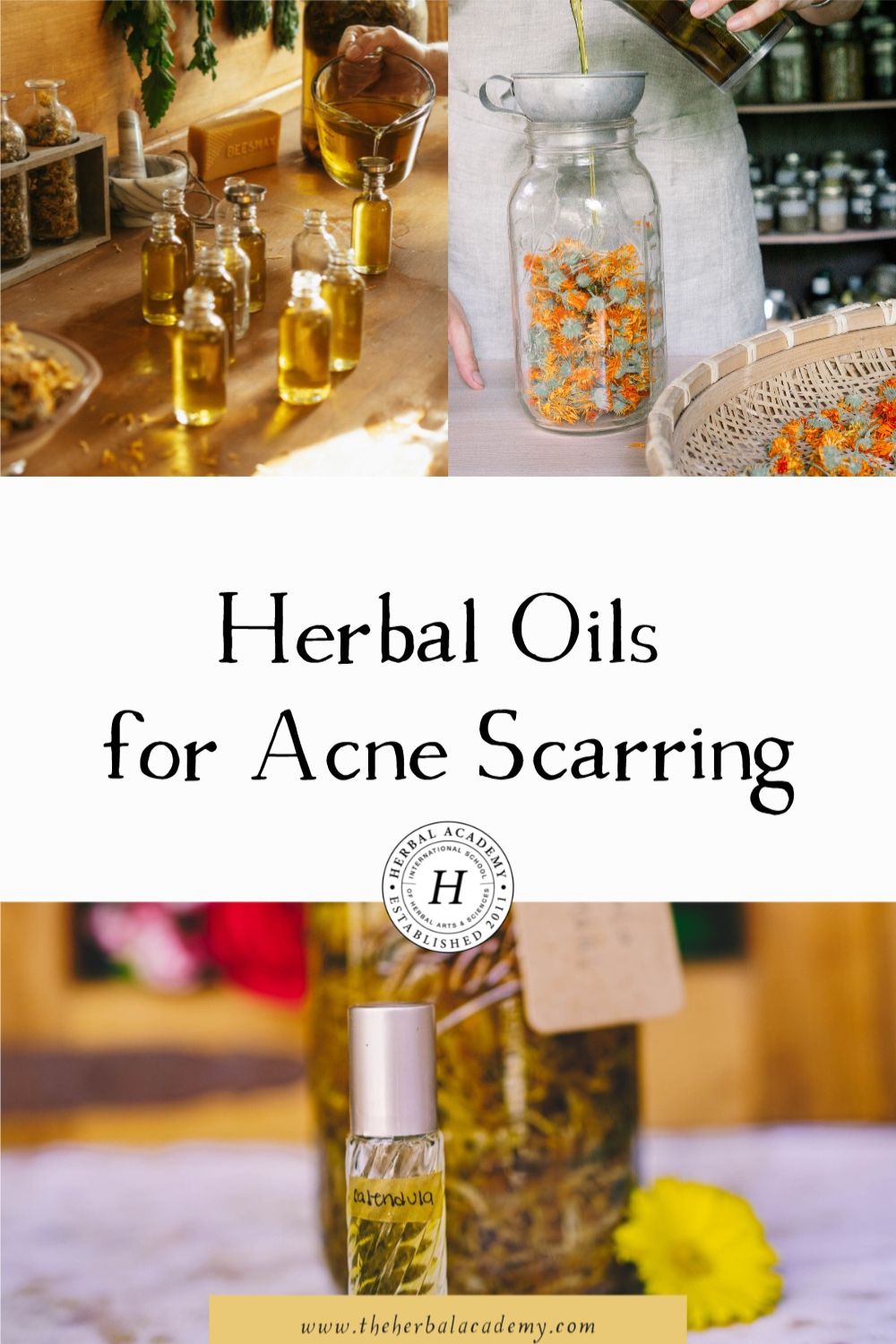 Herbal Oils for Acne Scarring | Herbal Academy | These herbal face oils give our skin the love it needs at just the right time, and are an effective natural option to reduce the chances of acne scarring.