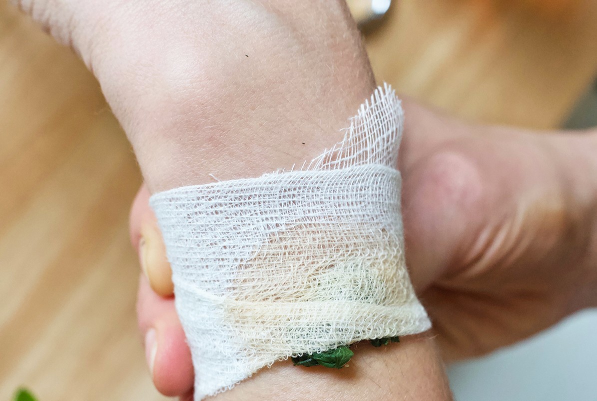 herbal poultice on arm 